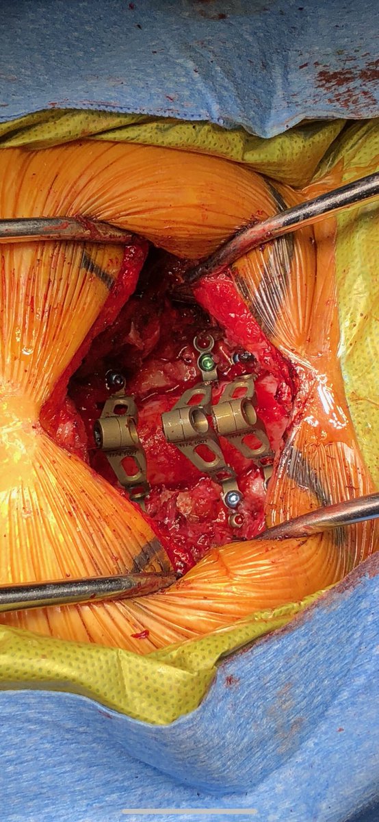 Motion Spine Institute (@grahammouwmd) on Twitter photo 