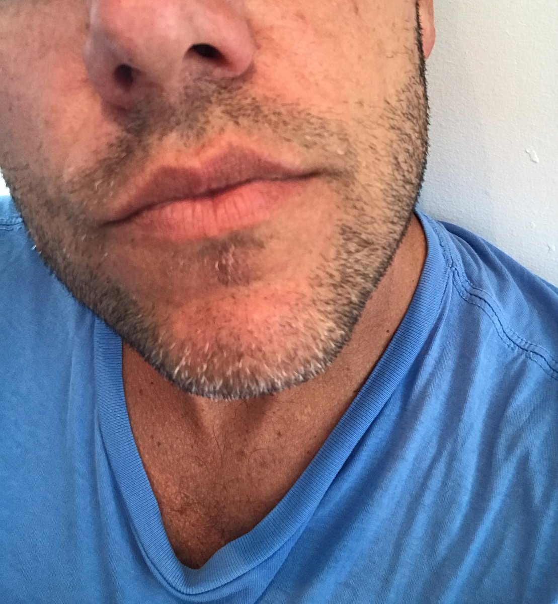 gianmarcomusica's tweet photo. #barba ó #nobarba ?🤔 https://t.co/A716L2dcj0