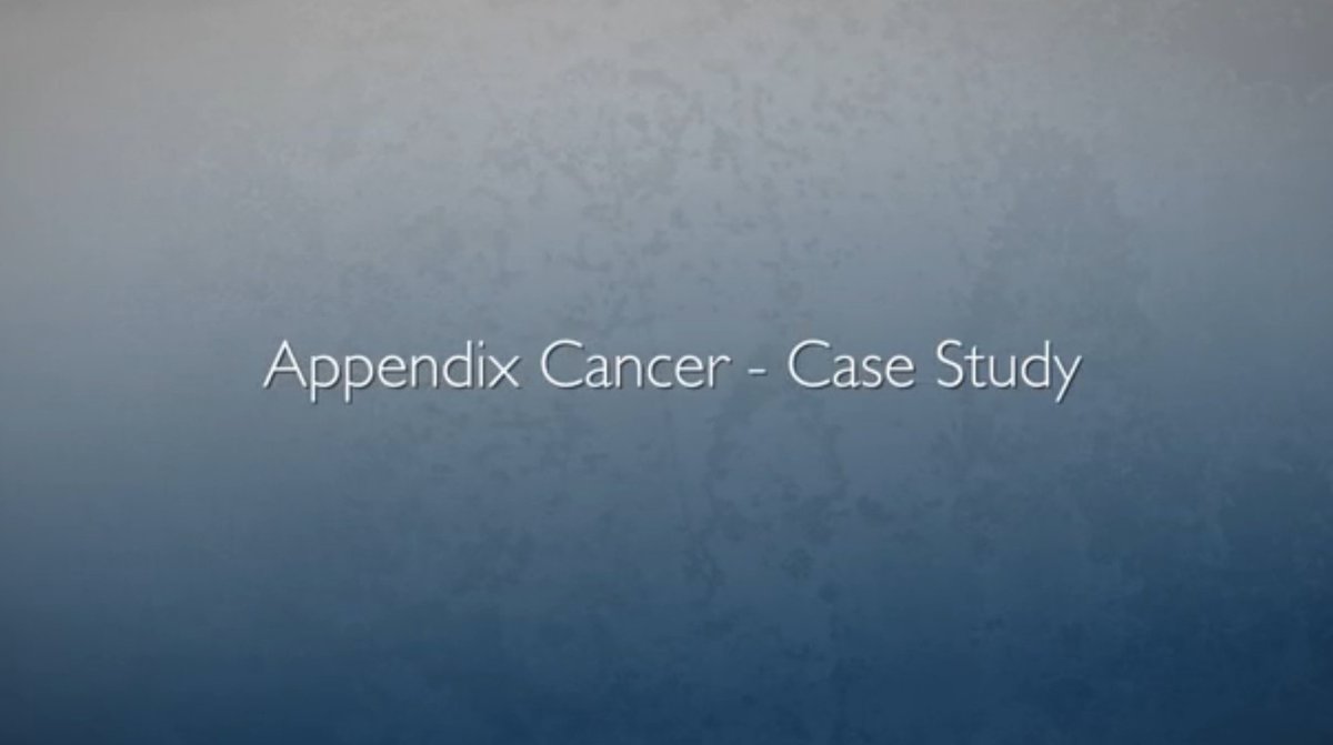HopkinsMedicine's tweet photo. #ClinicalCaseStudy: Dr. Nita Ahuja presents a case of a 54-year-old male w/ low-grade appendiceal mucinous neoplasms https://t.co/ljImdIO9nT https://t.co/I65KSzENiJ