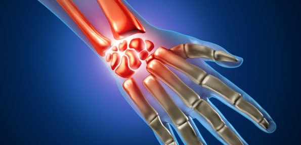 Consultant360's tweet photo. Are you caught up with our Rheumatology news? Check out our Medical Resource Center for more: https://t.co/6pNjSMHvmk // #CONrheumatology #rheumatology #pain #CONpain #jointpain #bonehealth #osteology #orthopedics #primarycare https://t.co/UrPiSrCMJi