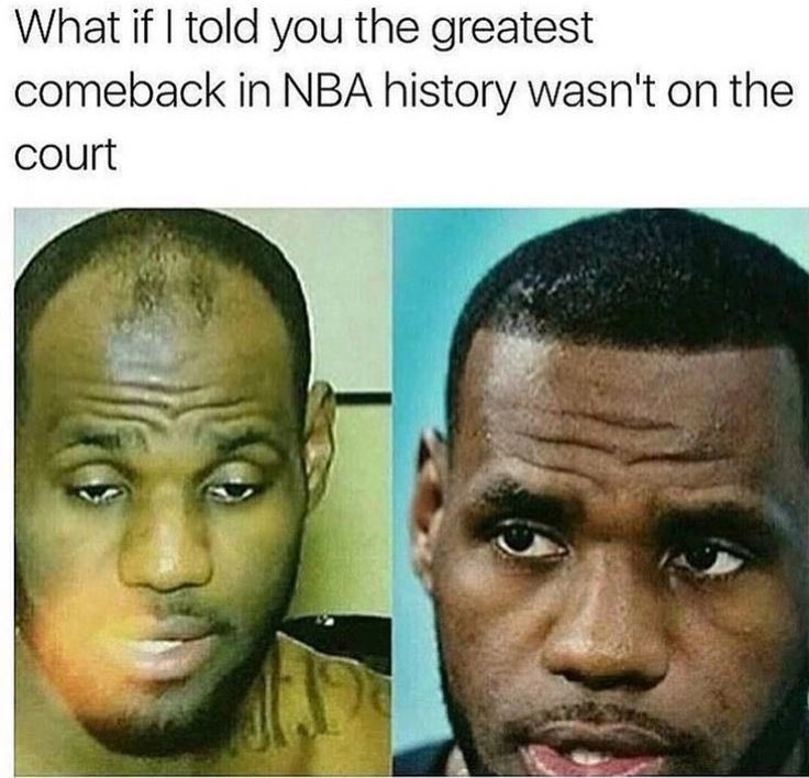 I know I m late to the game, but better late than never. Happy 33rd birthday to Lebron James hairline. 