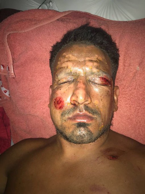 Ver imagen en Twitter Ver imagen en Twitter