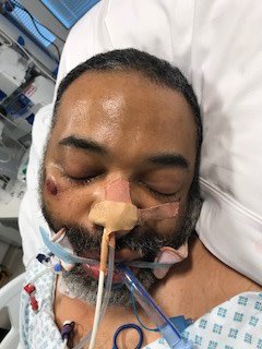 Appeal to identify man found collapsed near University College Hospital in #Camden. Suffered heart attack and currently in induced coma. We meed to trace his family as soon as possible. Call Central North CID on 101 with any info https://t.co/ap591dMjvi https://t.co/9oKLRiHsZO