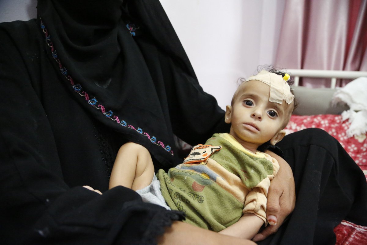WFP's tweet photo. “Yemen has passed the tipping point into a rapid decline from crisis to deepening catastrophe. #Yemen’s families cannot withstand another day of war, let alone another 1,000.” 

Heads of @WFP, @WHO and @UNICEF in a joint statement→ https://t.co/ahu2Bb0LtM https://t.co/739amWMysh