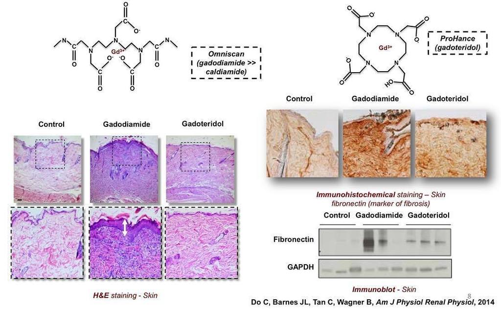 Wagner_Nephro's tweet photo. Differential effects of gadolinium-based contrast agents, https://t.co/kN6QOIArYM https://t.co/889eq9MnCj https://t.co/H50s3v6mQn
