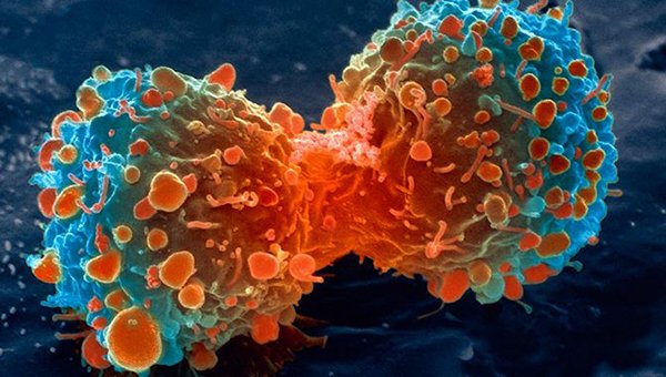 theNCI's tweet photo. Cancer cells differ from normal cells in many ways that allow them to grow out of control and become invasive: https://t.co/lRFtYIbS2C https://t.co/YBpP0VFk3S