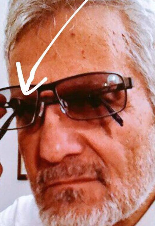SpotLowVision's tweet photo. Lets make 2018 different for you and turn you a “seeing”man. No #VisualField constriction and a beautiful spectacle like normal glasses. #MiniTelescopicSpectacle can make a difference in the lives of #VisuallyImpaired people. #lowvision #ARMD #Stargardts #rehabilitation #SMD https://t.co/McWqE9RgV0