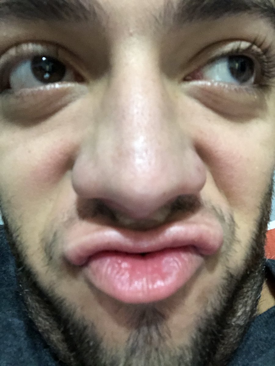 LucasRanngel's tweet photo. - ai miga! Tô firme na dieta viu

- jura miga?! Quanto tempo tu n come besteira?

- desde o ano passado https://t.co/rkh7nRjanA