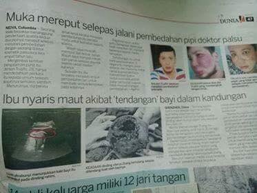 Doaa_CV's tweet photo. Rahim pecah &amp; bayi menendang : TIADA KAITAN

#MedTweetMY https://t.co/eQ71hJUQmB