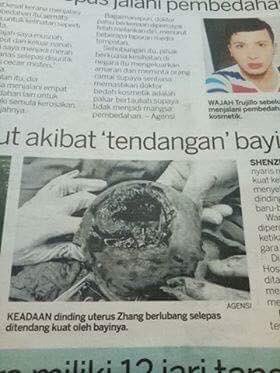Doaa_CV's tweet photo. Rahim pecah &amp; bayi menendang : TIADA KAITAN

#MedTweetMY https://t.co/eQ71hJUQmB