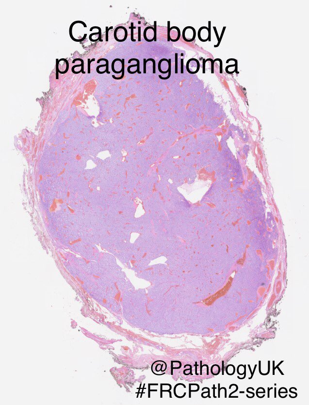 DigitalPathJC's tweet photo. @RCPath #pathboards #FRCPath2-series #Pathology #ENTPath https://t.co/pTjopHUygf