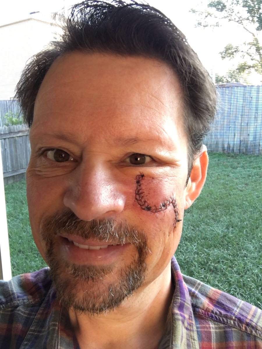 DASHR's tweet photo. @carrieunderwood so sorry to hear of your injury. However, it does get better. Surgery in September - me in December. God bless your healing. https://t.co/Frc1br63UG
