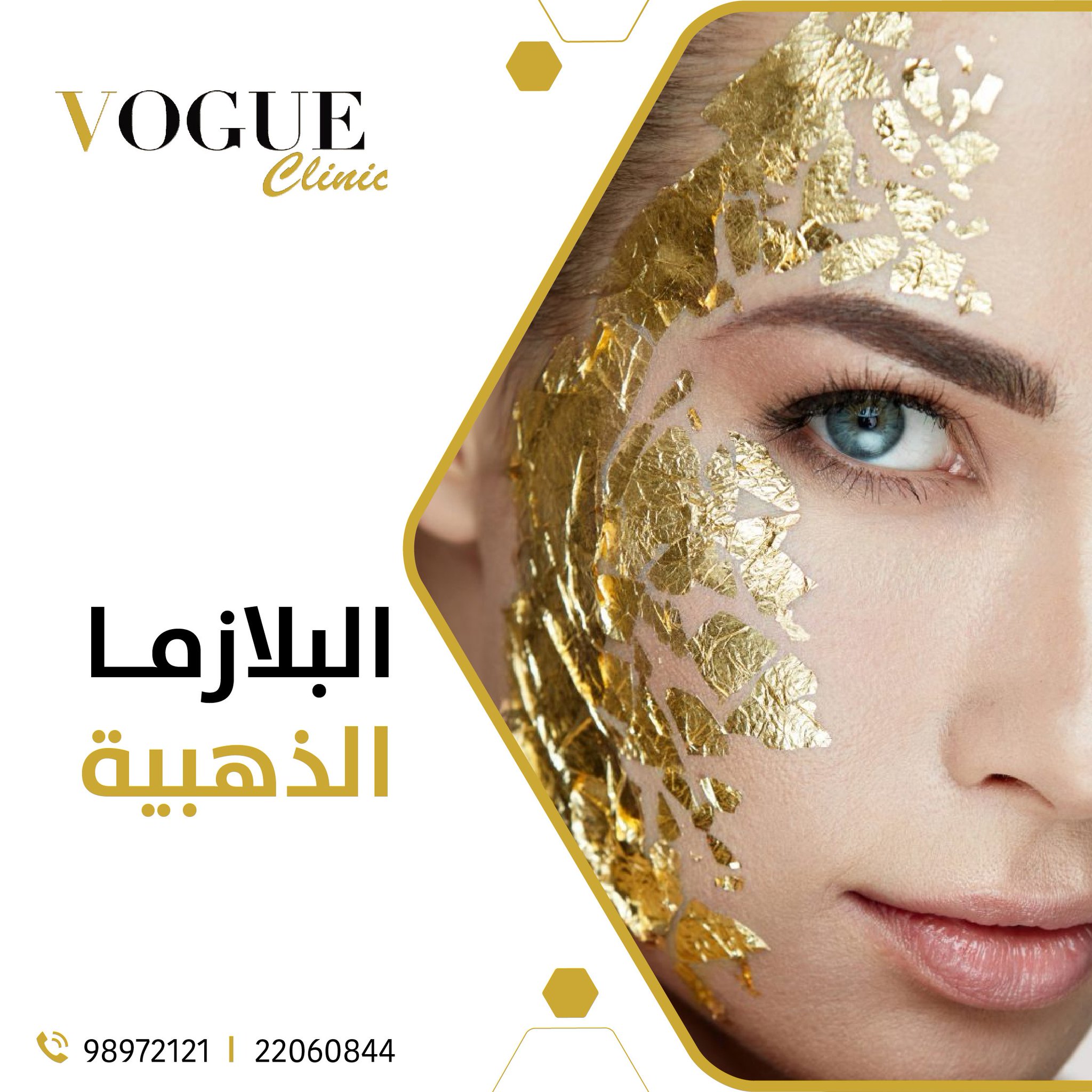 Vogue Clinic U Tvittri دع بشرتك تشع مع تقنية حقن البلازما. البلازما الذهبية. إضافة البلازما مع حمض الهيالورونيك لإعطاء نضارة وامتلاء للبشرة. الخيوط الجراحية، كربوكسي البوتوكس، الهالات السوداء، ميزوثيرابي الشعر PRP
