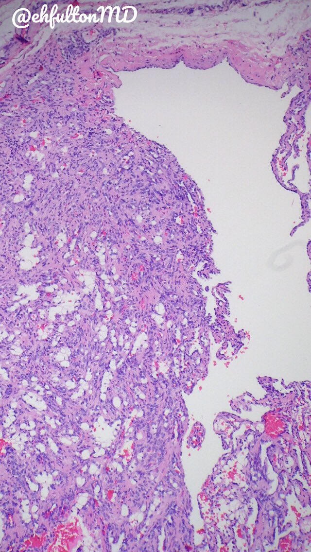 Edward Fulton, MD tweet media