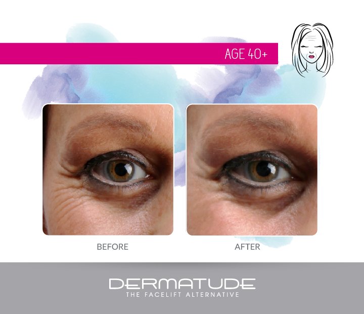 DermatudeUK's tweet photo. Dramatically reduce fine lines &amp; wrinkles for a brighter, younger complexion going into this new year.

#dermatude #discoverdermatude #skincare #antiageing https://t.co/NpVaDKNLth