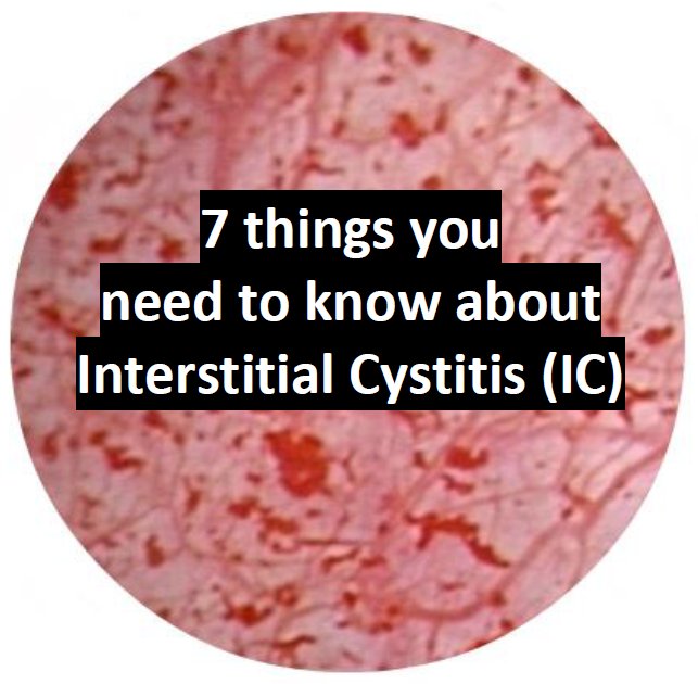 targstique's tweet image. 7 Things You Need To Know About Interstitial Cystitis (IC) 📩 Download the free e-paper today: ic-today.com/e-paper/ #epaper #interstitialcystitis