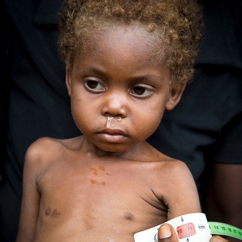 World Food Programme on Twitter "Looking back at 2017. A year of