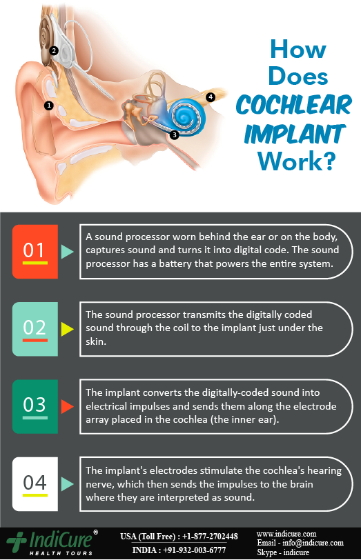 IndiCure's tweet photo. https://t.co/UdVYXjN3Xn
#Cochlear #DidYouKnow #CochlearImplant #HearingAid #HearingLoss #BionicEar #CochlearImplantSurgery #IndiCure https://t.co/Tfd4l3Lqas