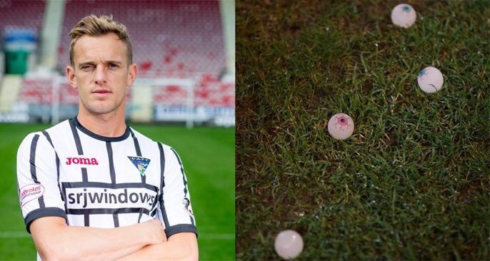 Dunfermline Athletic'le Falkirk arasında oynanan maçta Falkirk taraftarları, 8 yaşında geçirdiği bir kaza nedeniyle sağ gözünü kaybeden Dean Shiels'la dalga geçmek için sahaya takma göz attı. Orospu Çocukları.