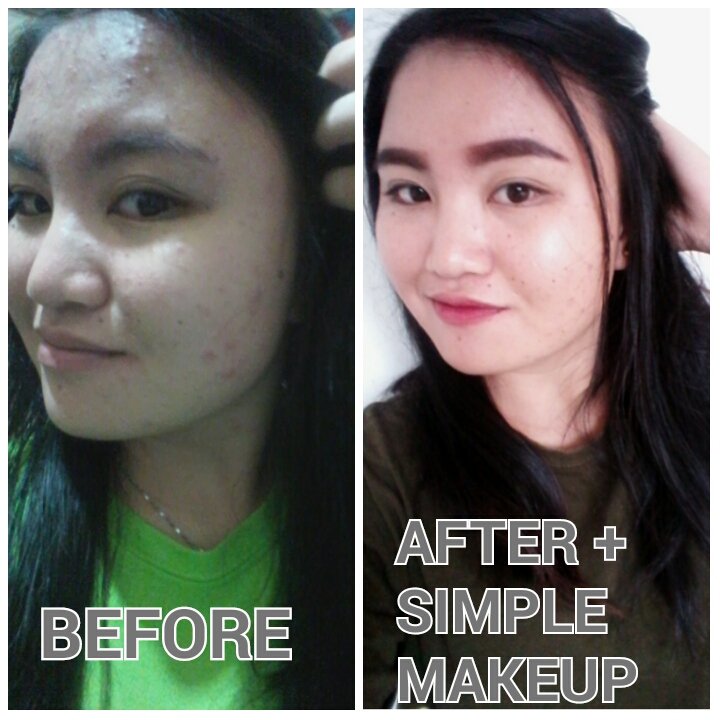 EElresta's tweet photo. Thanks snelasoul product heal my skin. Mengalami masalah jerawat yang teruk? Kulit sensitif? Kulit kusam dan berminyak? Mari cuba snelasoul produk. Sis sdh cuba memang berkesan. Pm sis ya, 0167873121@elis

#dropshiptrustedseller 
#snelasouluser https://t.co/zyleEAlcXO