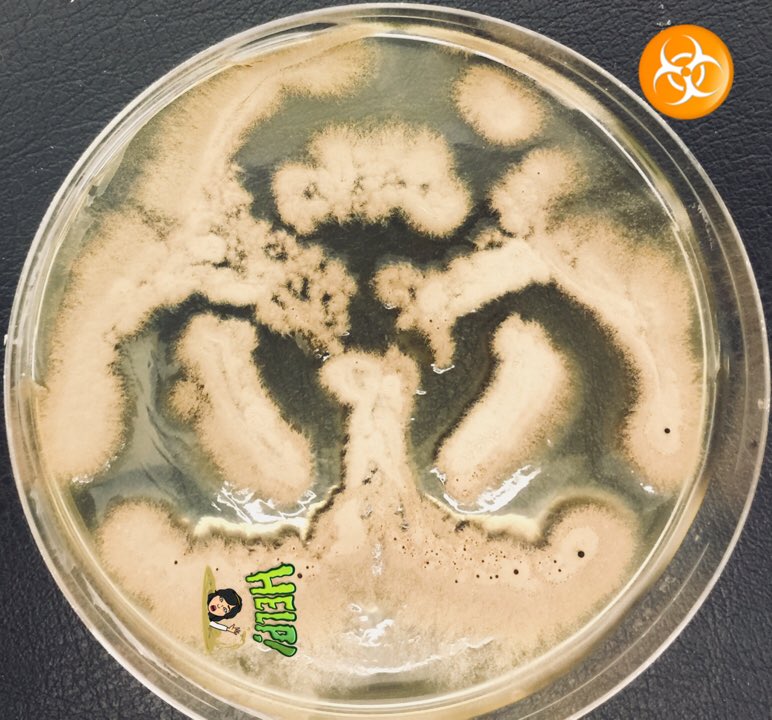 AiahKhateb's tweet photo. What better way to procrastinate #PhD #thesis #scicomm #sciart #Biohazard #aspergillus #fumigatus #spores #hold_your_breath #MFIG #Manchester #University #UofM https://t.co/SYuZeLUDd8