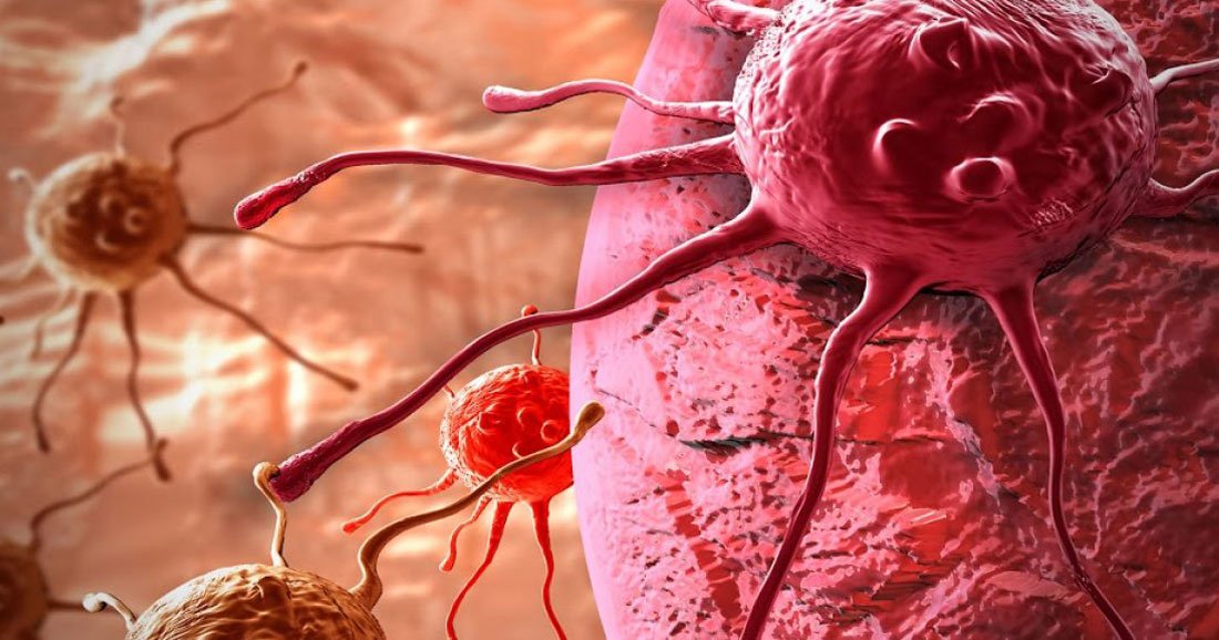 DailyGeekShow's tweet image. Véritable espoir : des chercheurs découvrent le premier virus "thérapeutique" qui combat le cancer
dailygeekshow.com/?p=472057