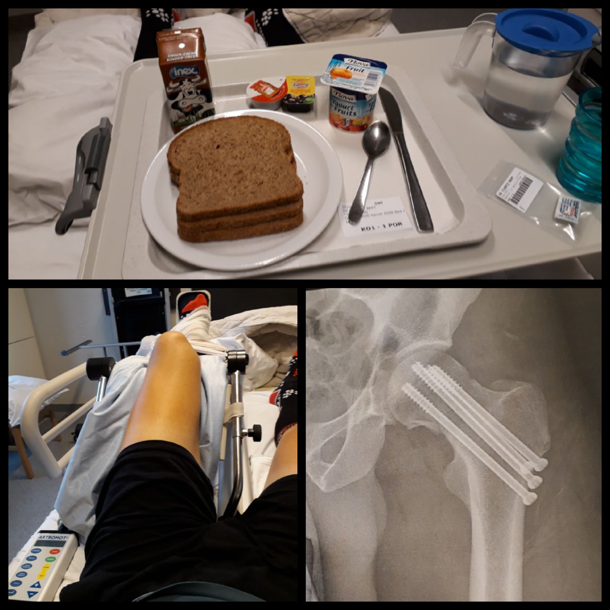 Back home after hip surgery and few days of hospital in <a href="/azherentals/">AZ Herentals</a>. Long revalidation to go now but I hope to be able to show my new @TeamWantyGobert-jersey as soon as possible!