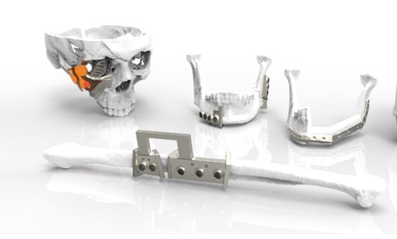 RenishawUSA's tweet photo. We've partnered up with Advanced Digital Technology Foundation. Thrilled to add our #additivemanufacturing experience to the #healthcare sector! https://t.co/HE6aiA4yIq https://t.co/mUB9OQv4k9
