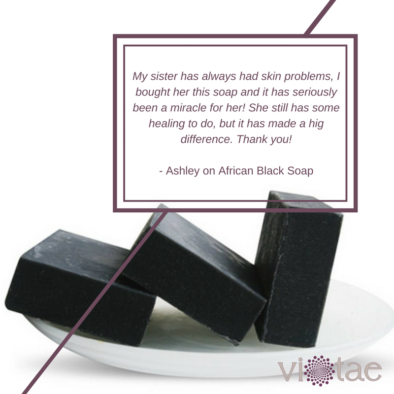 ViTaeProducts's tweet photo. Our African Black Soap has some BIG fans! See for yourself...
#NaturalBeauty #AfricanBlackSoap #ViTae
https://t.co/5gaZK2u01V https://t.co/2AW28k32Eb