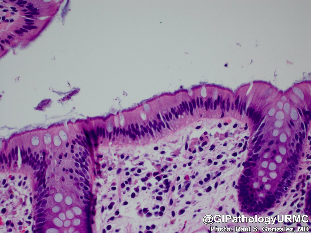 GIPathologyURMC tweet picture