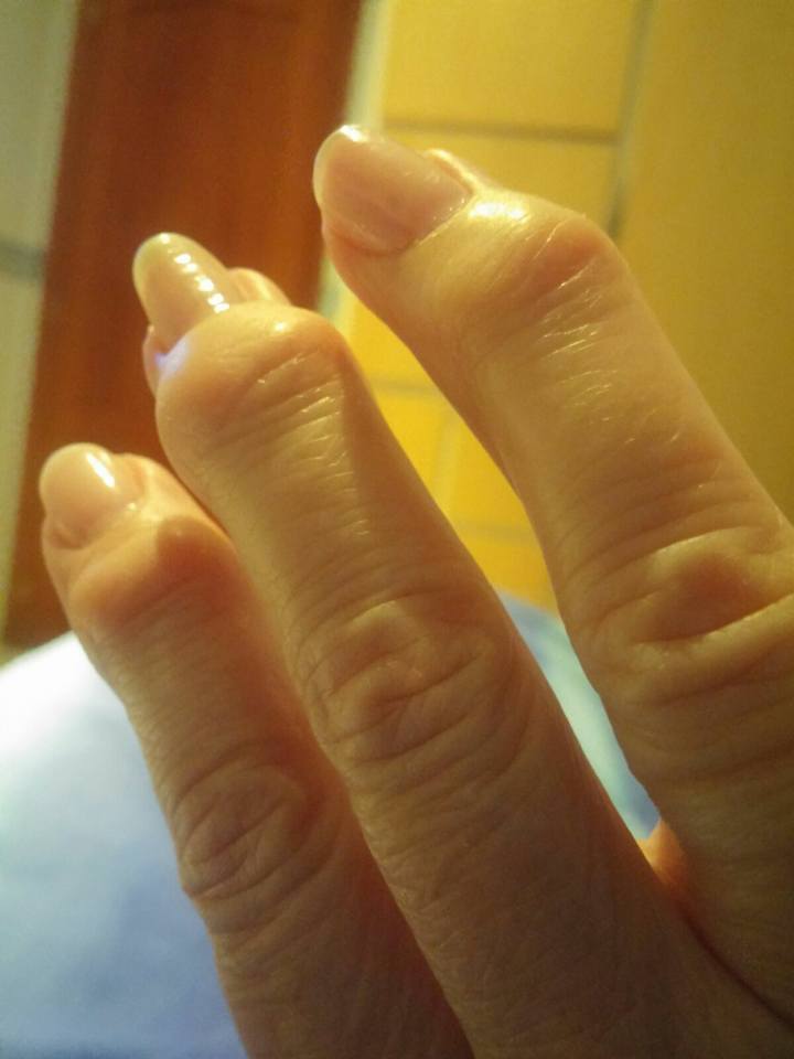 Esta es la mano de una de <a href="/LAS_KELLYS/">Las Kellys</a> después de 30 años trabajando. El gobierno dice que se trabaja poco para justificar su destrucción del sistema público de pensiones. El problema no es que los españoles trabajan poco, es que ellos no paran de robar.