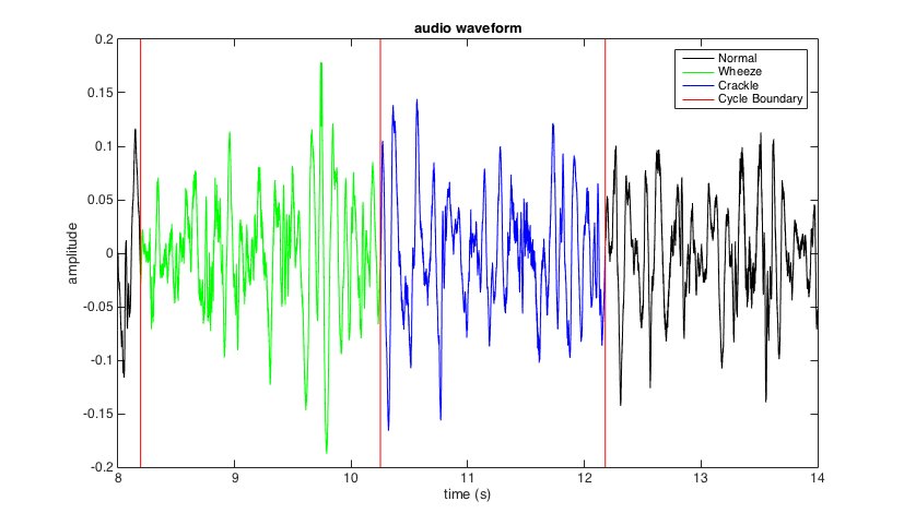 read compression schemes for mining large datasets a machine learning perspective 2013