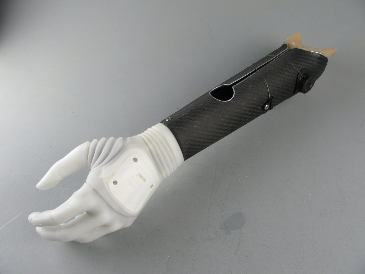 PaceRehab's tweet photo. Work-in-progress shots of a new #prosthesis Bryan and Paul are working on . Pre-preg carbon fiber shell for reduced weight, silicone inner socket for improved comfort and #REVOFit adjust-ability… and the hands not bad either! #amputee https://t.co/TZWVcNIPUe