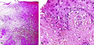 ClinicalPathol's tweet photo. #Histopathology refers to the microscopic examination of tissue in order to study the manifestations of #disease. https://t.co/fqGNEKSnnC