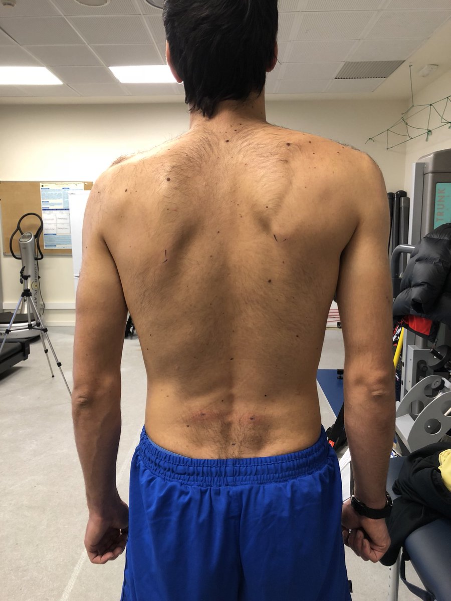 Dolor en trapecio izquierdo