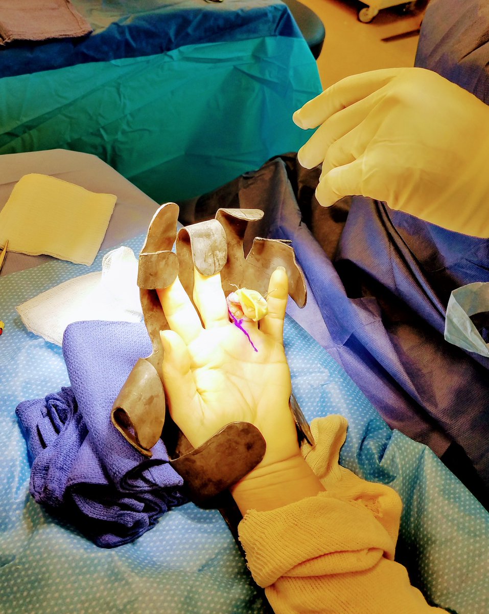 executivecortex's tweet photo. Last case b4 happy hour :)
100% #USGRA supraclavicular block @ASRA_Society @ASALifeline @NYSORA #executivecortex https://t.co/tVMA9BFLNq