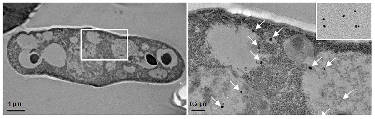 ToxSci's tweet photo. Genome wide screening in yeast to understand #SilverNanoparticle toxicity. #EditorsHighlight #OpenAccess https://t.co/nqJ7Dxpv4i https://t.co/y2MBf9Getf