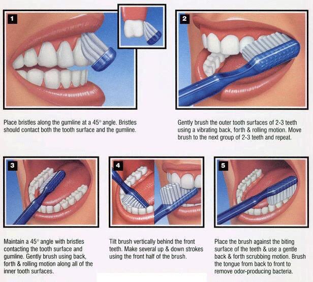 ftfdental's tweet image. Many people don&apos;t brush their teeth properly. This graphic shows the best way to brush. Brushing this way gives the best results for removing plaque and keeping your gums healthy.
#BrushRight #FTFDental #HowToBrushYourTeeth #CleanTeeth #HealthyTeeth #HealthyGums