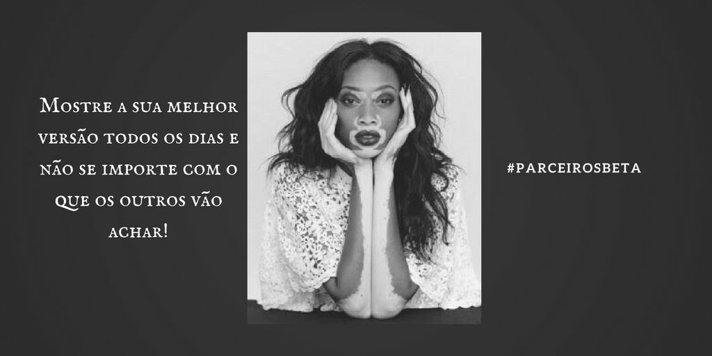 #ParceirosBeta <a href="/parceirosbeta/">#PARCEIROSBETA OFICI</a>
Sou o que eu sou, obrigado Deus por me dar um novo dia, e peço que cuide dos meus 🐼💗