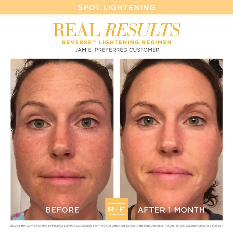 abkduran3's tweet image. A new day, means a new regimen...
Brighten your skin and say &quot;see ya later&quot; sun spots with REVERSE! Our Reverse Lightening regimen exfoliates and reduces the appearance of age spots and sun damage.

Are you ready to reverse the damage done to your skin? Let&apos;s chat!