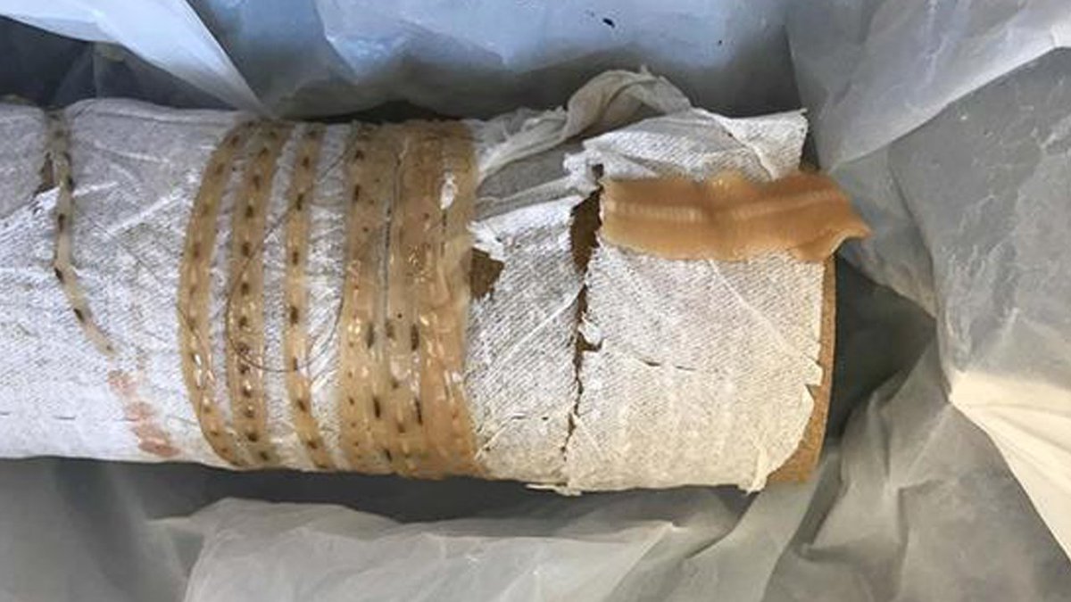 Sushi-loving man pulls 5-AND-A-HALF FOOT tapeworm out of his own body bit.ly/2EXVlaB?utm_so… https://t.co/DWxaA8Zuq2