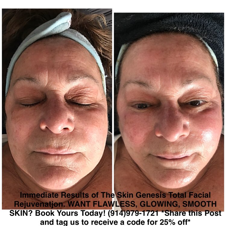 TheSkinSource's tweet image. Want FLAWLESS, LUMINOUS &amp;amp; SMOOTH  skin?!!

*Retweet for 25% off* 

#skincare #skincareroutine #skin  #newyear #newyearnewme #newyearnewyou  #2018goals #beauty #beautyblogger #makeup #westchester #stamford #transformation #flawless #trending #smooth #goals #newyork #yonkers
