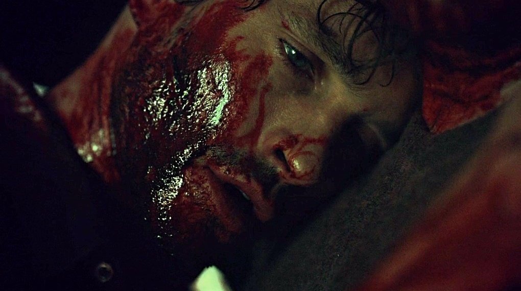 Rebel Rebel, your face is a mess
Rebel Rebel, how could they know?

#HannibalDailyDose