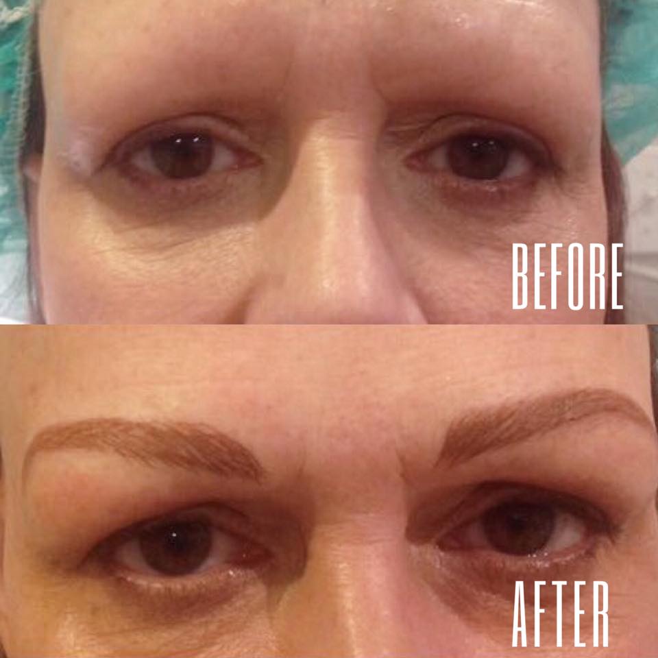 midwestaging's tweet image. Never fill your eyebrows in again! 💁‍♀️We are now offering microblading at our spa ✨ These are the results of our very first client, and she was thrilled 😁 with her results! Call us to schedule an appointment now! 
☎️ : (815) 277-5229
#microblading #eyebrows