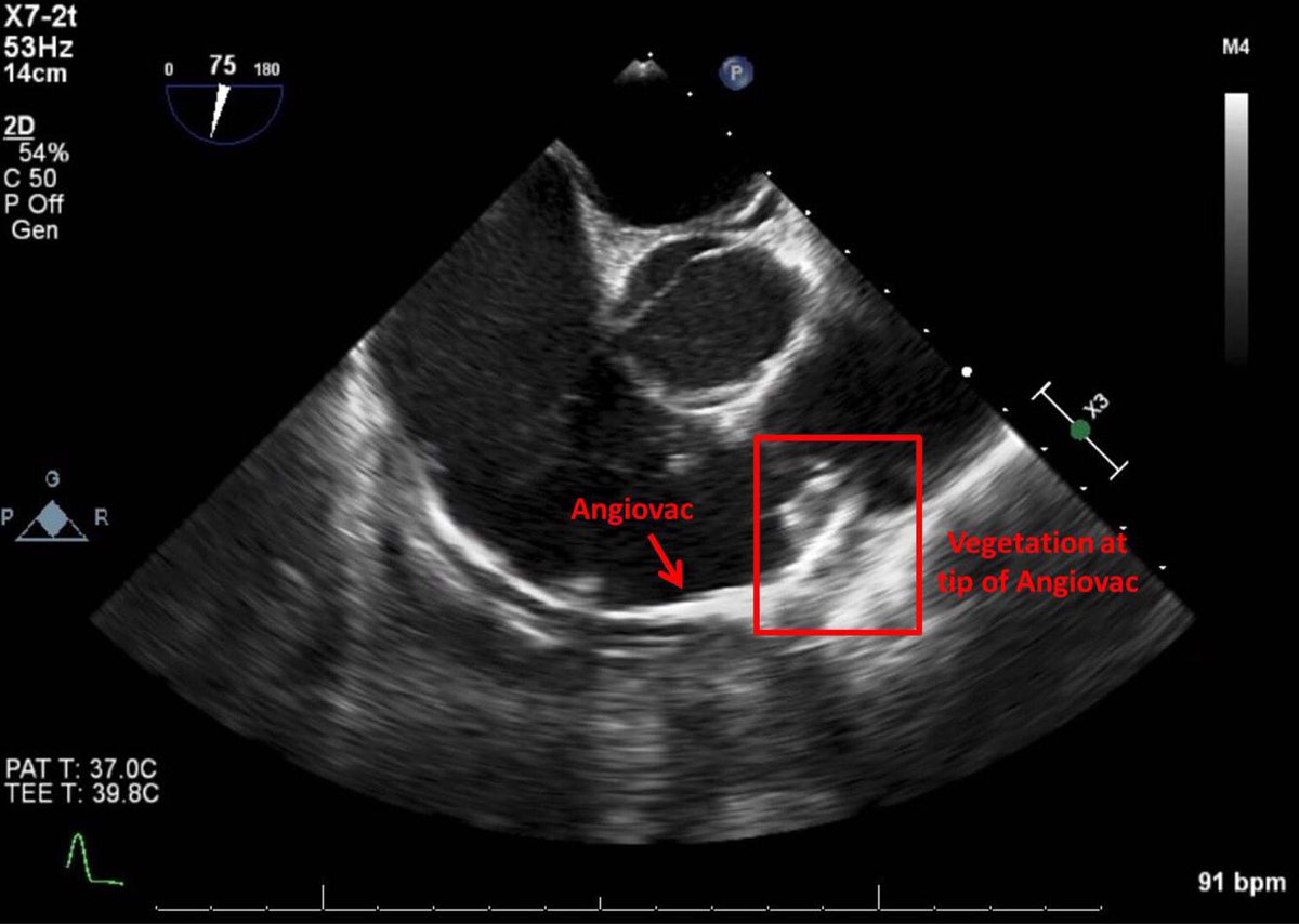 Albany IR tweet media