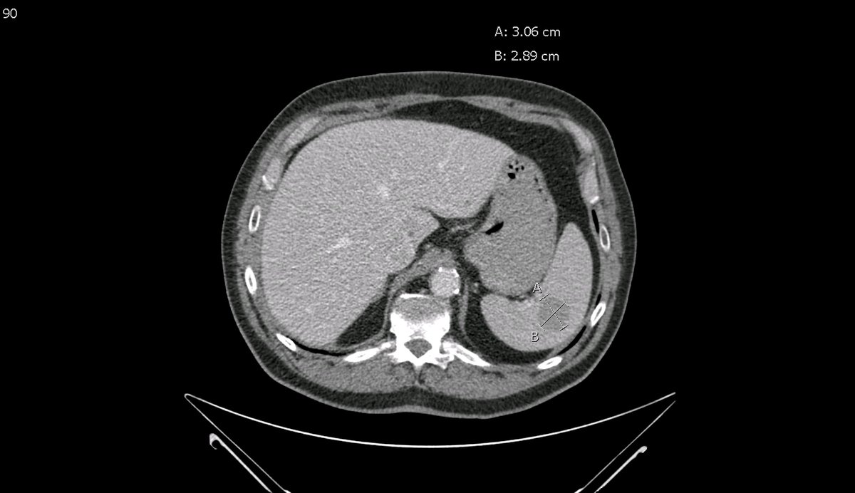 Roger Williams_IR tweet media