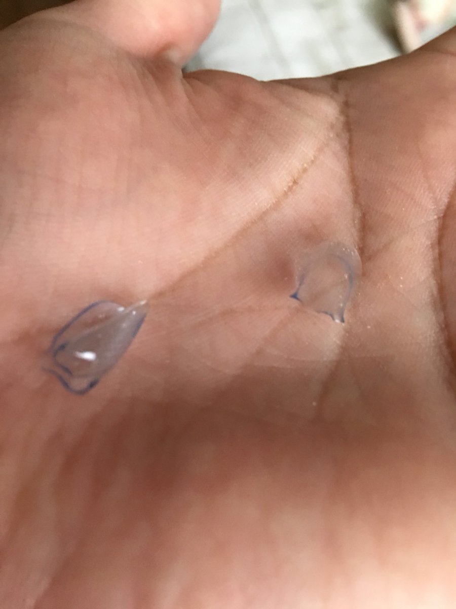 はやと On Twitter 干からびたコンタクトレンズ 水で戻したらまた使えそう