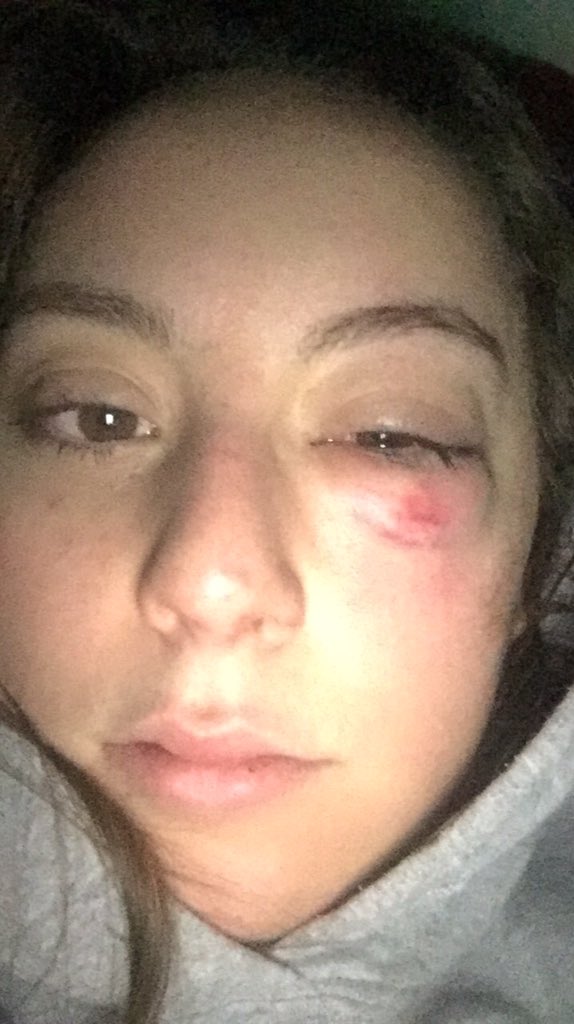 I've been told my New Years resolution should be to not play soccer anymore... 😬🙃🤷🏼‍♀️
