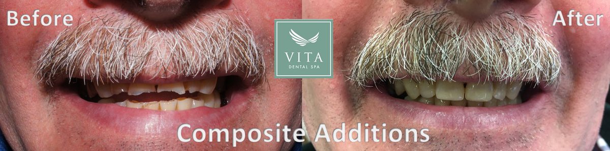 #tranformationtuesday #beforeandafter