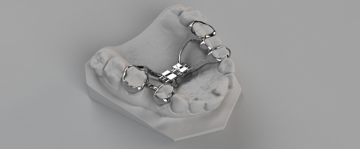 World Premiere!

Available at SLS France on Monday the 15th the expansion screw all made by CAD/CAM technologies. Include screw, finishing and assembling. Two other products will be ready for commercialization. More information? Contact us at axel.dubois@sls-france.fr